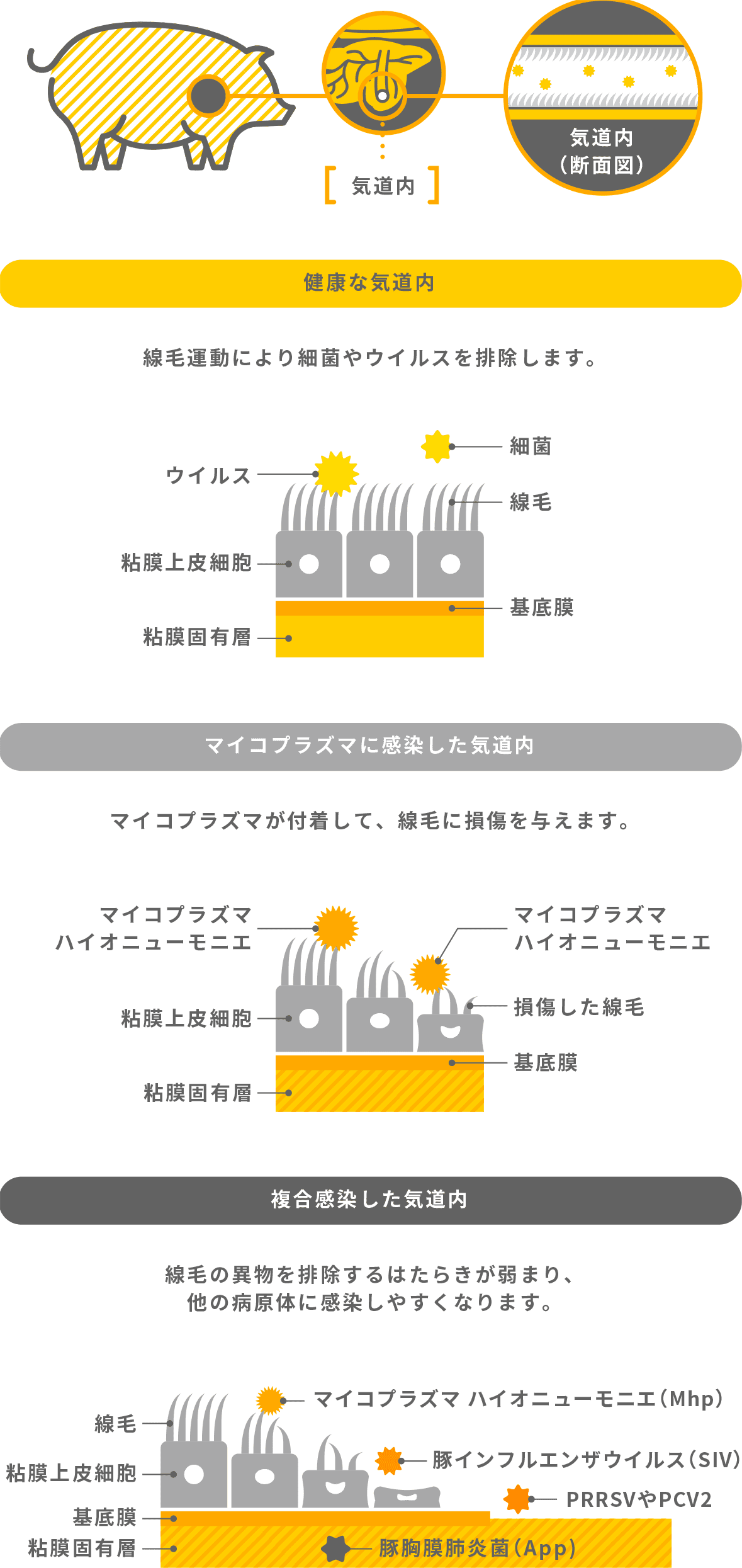 マイコプラズマ 肺炎 原因